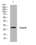 Western blot analysis of lysates from HuvEc cells, primary antibody was diluted at 1:1000, 4°C overnight STJ195256