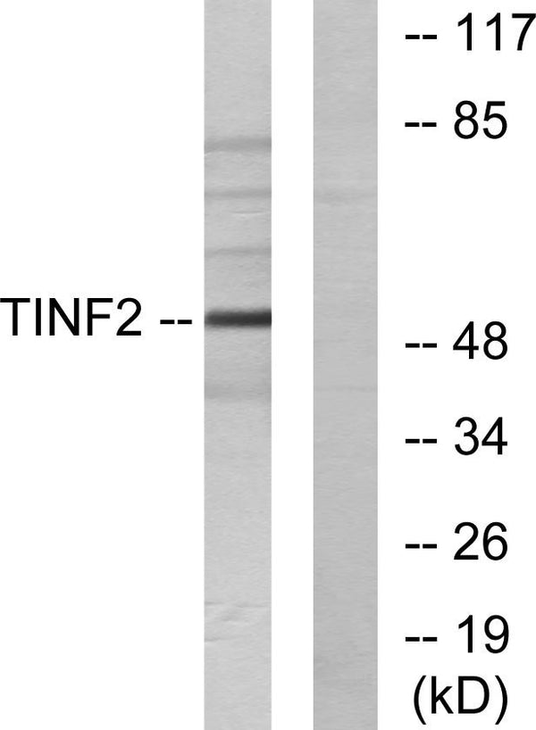 Western blot analysis of lysates from HUVEC cells, using TINF2 Antibody. The lane on the right is blocked with the STJ96027