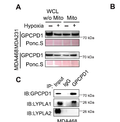 Hypoxia-induced GPCPD1 depalmitoylation triggers mitophagy via regulating PRKN-mediated ubiquitination of VDAC1. STJ190508