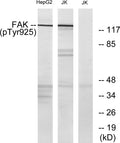 Western blot analysis of lysates from Jurkat and HepG2 cells, using FAK (Phospho-Tyr925) Antibody. The lane on the STJ90269