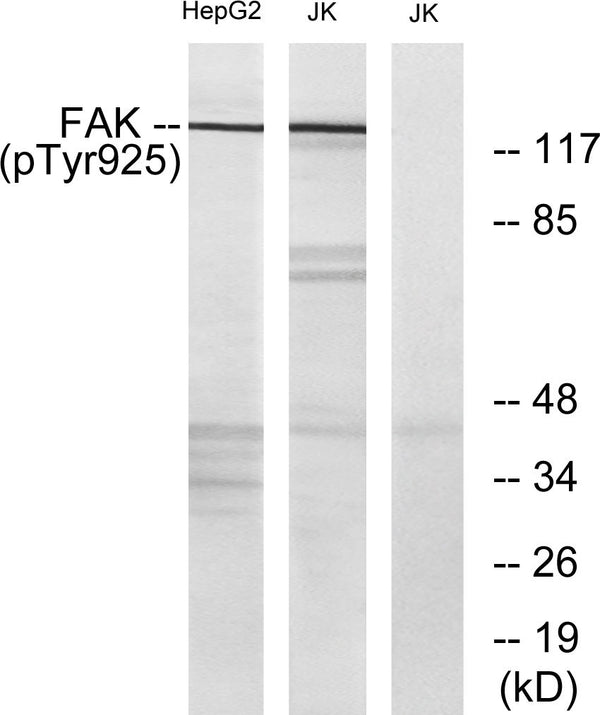 Western blot analysis of lysates from Jurkat and HepG2 cells, using FAK (Phospho-Tyr925) Antibody. The lane on the STJ90269