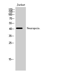 Western Blot analysis of Jurkat cells using Neuropsin Polyclonal Antibody STJ94441