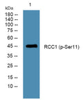 Western blot analysis of lysates from Jurkat cells, primary antibody was diluted at 1:1000, 4°C overnight STJ194740