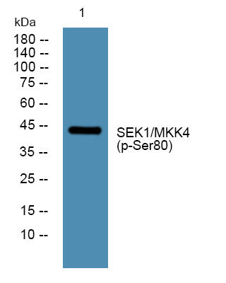 Western blot analysis of lysates from Jurkat cells, primary antibody was diluted at 1:1000, 4°C overnight STJ194744