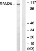 Western blot analysis of lysates from Jurkat cells, using RBM26 Antibody. The lane on the right is blocked with the STJ95392
