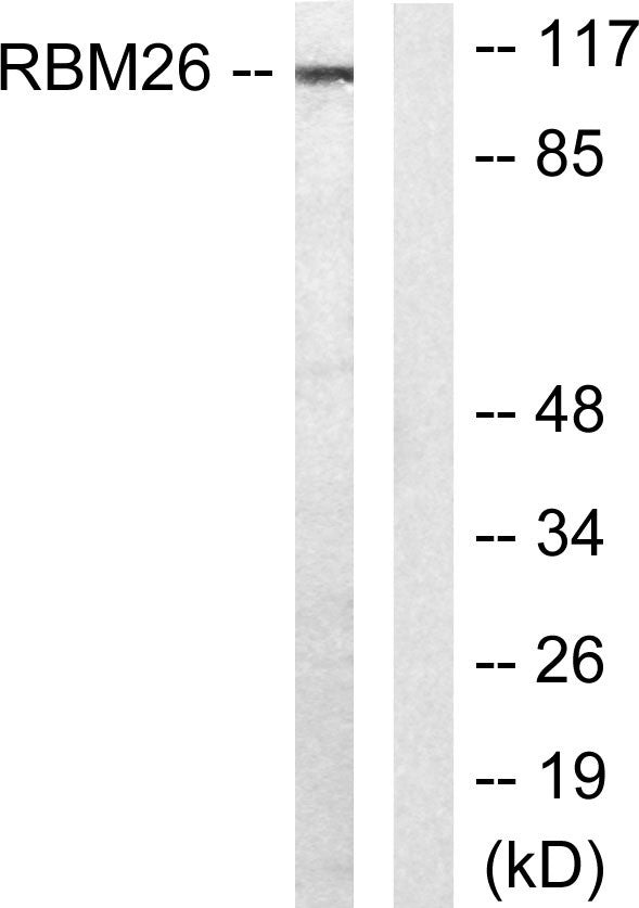 Western blot analysis of lysates from Jurkat cells, using RBM26 Antibody. The lane on the right is blocked with the STJ95392