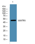 Western blot analysis of lysates from K562 cells, primary antibody was diluted at 1:1000, 4°C overnight STJ191805