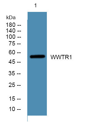 Western blot analysis of lysates from K562 cells, primary antibody was diluted at 1:1000, 4°C overnight STJ191805