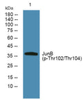 Western blot analysis of lysates from K562 cells, primary antibody was diluted at 1:1000, 4° overnight STJ194714