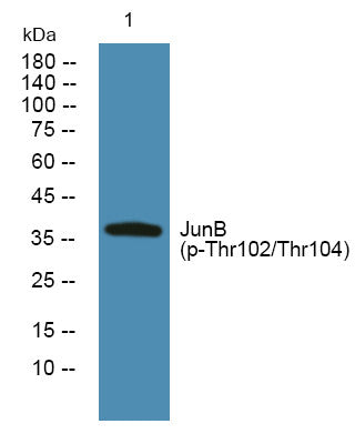 Western blot analysis of lysates from K562 cells, primary antibody was diluted at 1:1000, 4° overnight STJ194714