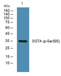 Western blot analysis of lysates from K562 cells, primary antibody was diluted at 1:1000, 4°C overnight STJ194746