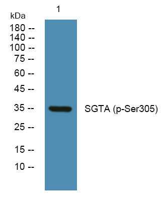 Western blot analysis of lysates from K562 cells, primary antibody was diluted at 1:1000, 4°C overnight STJ194746