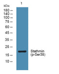 Western blot analysis of lysates from K562 cells, primary antibody was diluted at 1:1000, 4°C overnight STJ194749
