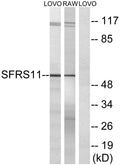 Western blot analysis of lysates from LOVO and RAW264.7 cells, using SFRS11 Antibody. The lane on the right was blocked STJ95628