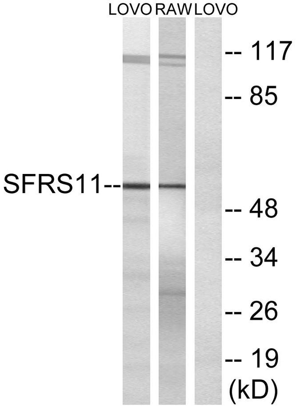 Western blot analysis of lysates from LOVO and RAW264.7 cells, using SFRS11 Antibody. The lane on the right was blocked STJ95628