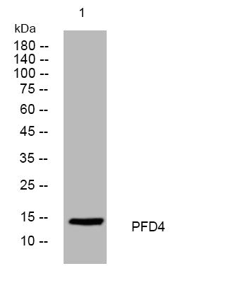 Western blot analysis of lysates from MCF-7 cells, primary antibody was diluted at 1:1000, 4°C overnight STJ195434