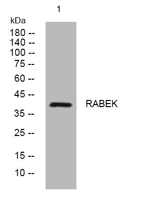 Western blot analysis of lysates from MCF-7 cells, primary antibody was diluted at 1:1000, 4°C overnight STJ196073