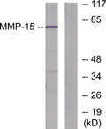 Western blot analysis of lysates from MDA-MB-435 cells, using MMP-15 Antibody. The lane on the right was blocked with STJ94276