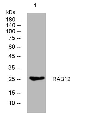 Western blot analysis of lysates from MDA-MB cells, primary antibody was diluted at 1:1000, 4°C overnight STJ196007