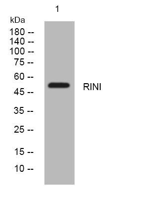 Western blot analysis of lysates from PC-12 cells, primary antibody was diluted at 1:1000, 4° overnight STJ194975