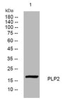 Western blot analysis of lysates from KB cells, primary antibody was diluted at 1:1000, 4°C overnight STJ195290