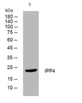 Western blot analysis of lysates from PC-12 cells, primary antibody was diluted at 1:1000, 4° overnight STJ195795