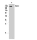 Western Blot analysis of JK cells using RBM16 Polyclonal Antibody, cells nucleus extracted by Minute™ Cytoplasmic and STJ95391