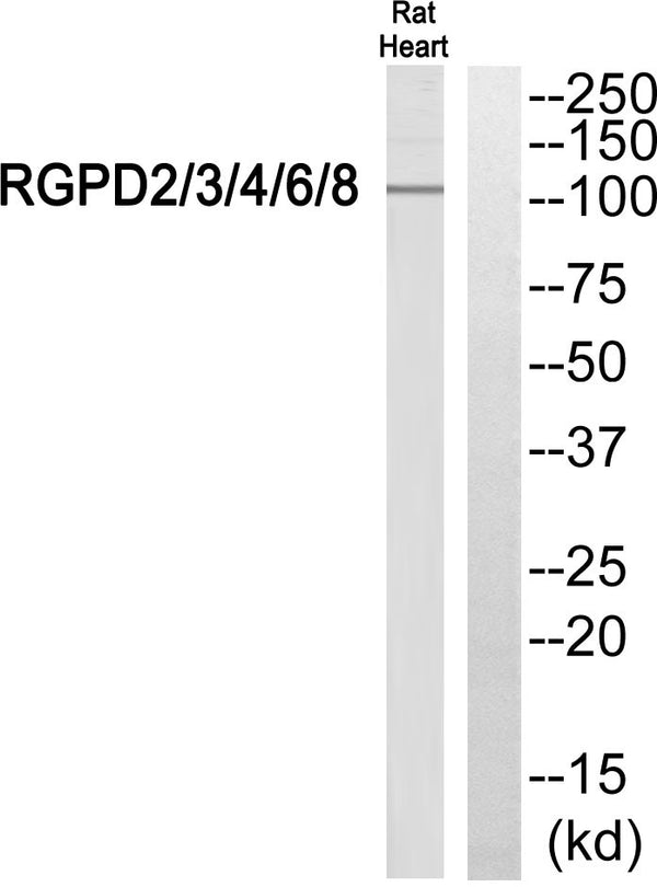 Western blot analysis of RGPD2/3/4/6/8 Antibody. The lane on the right was blocked with the RGPD2/3/4/6/8 peptide. STJ95433