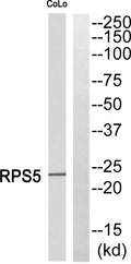 Western blot analysis of RPS5 Antibody. The lane on the right is blocked with the RPS5 peptide. STJ95502