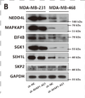 SP1-Induced Upregulation of LncRNA AFAP1-AS1 Promotes Tumor Progression in Triple-Negative Breast Cancer by Regulating STJ193468
