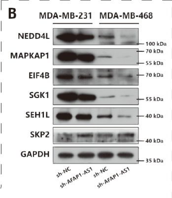 SP1-Induced Upregulation of LncRNA AFAP1-AS1 Promotes Tumor Progression in Triple-Negative Breast Cancer by Regulating STJ193468