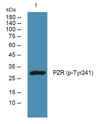 Western blot analysis of lysates from SW480 cells, primary antibody was diluted at 1:1000, 4°C overnight STJ194737