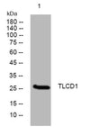 Western blot analysis of lysates from SW480 cells, primary antibody was diluted at 1:1000, 4°C overnight STJ194939
