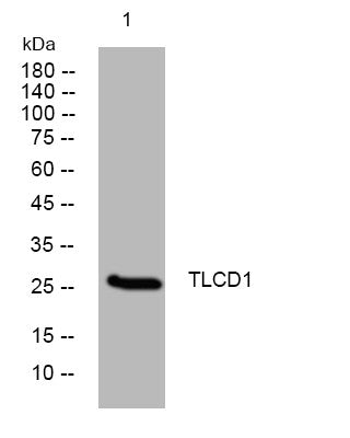 Western blot analysis of lysates from SW480 cells, primary antibody was diluted at 1:1000, 4°C overnight STJ194939