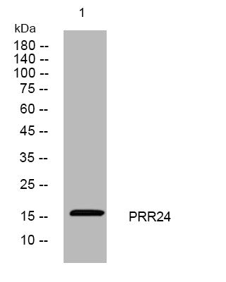 Western blot analysis of lysates from SW480 cells, primary antibody was diluted at 1:1000, 4°C overnight STJ195334