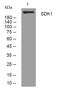 Western blot analysis of lysates from SW480 cells, primary antibody was diluted at 1:1000, 4°C overnight STJ195661