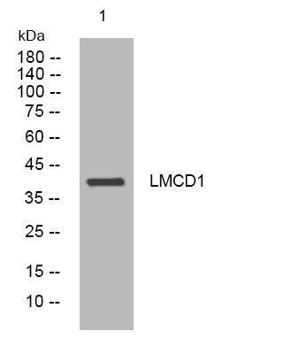 Western blot analysis of lysates from SW480 cells, primary antibody was diluted at 1:1000, 4°C overnight STJ195800