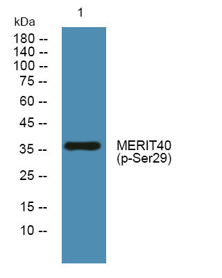 Western blot analysis of lysates from SH-SY5Y cells, primary antibody was diluted at 1:1000, 4°C overnight STJ194723