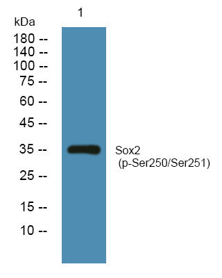 Western blot analysis of lysates from SH-SY5Y cells, primary antibody was diluted at 1:1000, 4°C overnight STJ194747