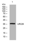 Western blot analysis of lysates from SH-SY5Y cells, primary antibody was diluted at 1:1000, 4°C overnight STJ194878