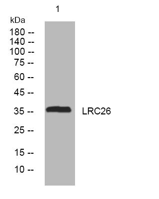 Western blot analysis of lysates from SH-SY5Y cells, primary antibody was diluted at 1:1000, 4°C overnight STJ194878