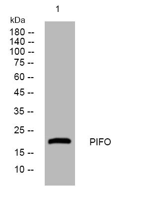 Western blot analysis of lysates from SH-SY5Y cells, primary antibody was diluted at 1:1000, 4°C overnight STJ195753