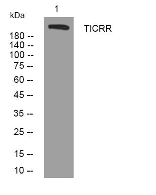 Western blot analysis of lysates from THP-1 cells, primary antibody was diluted at 1:1000, 4°C overnight STJ194782