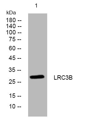 Western blot analysis of lysates from THP-1 cells, primary antibody was diluted at 1:1000, 4°C overnight STJ194951