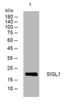 Western blot analysis of lysates from U2OS cells, primary antibody was diluted at 1:1000, 4° overnight STJ194855