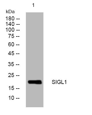 Western blot analysis of lysates from U2OS cells, primary antibody was diluted at 1:1000, 4° overnight STJ194855