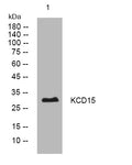 Western blot analysis of lysates from U2OS cells, primary antibody was diluted at 1:1000, 4°C overnight STJ194874