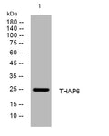 Western blot analysis of lysates from U2OS cells, primary antibody was diluted at 1:1000, 4°C overnight STJ195268