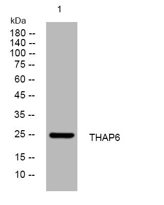 Western blot analysis of lysates from U2OS cells, primary antibody was diluted at 1:1000, 4°C overnight STJ195268