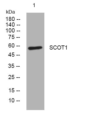 Western blot analysis of lysates from U2OS cells, primary antibody was diluted at 1:1000, 4° overnight STJ195682